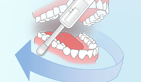 ORAL SWAB; AN EASY TECHNIQUEimage from ORAQUICK site